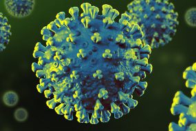 コロナ禍におけるマンション管理組合の対処方法 ６つのポイント！